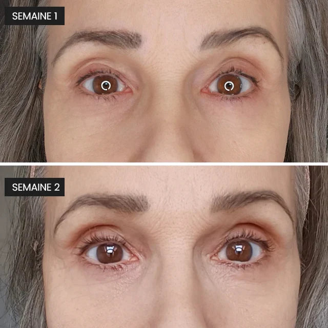 Lash Serum