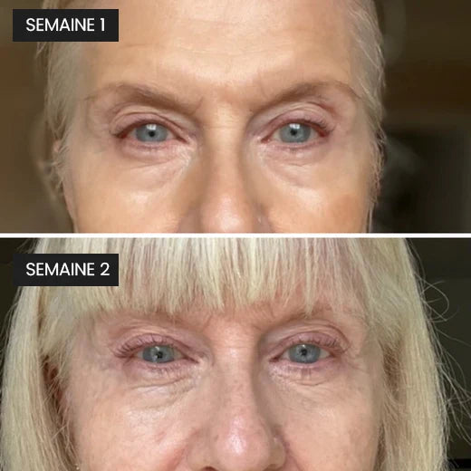 Lash Serum