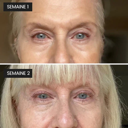 Lash Serum